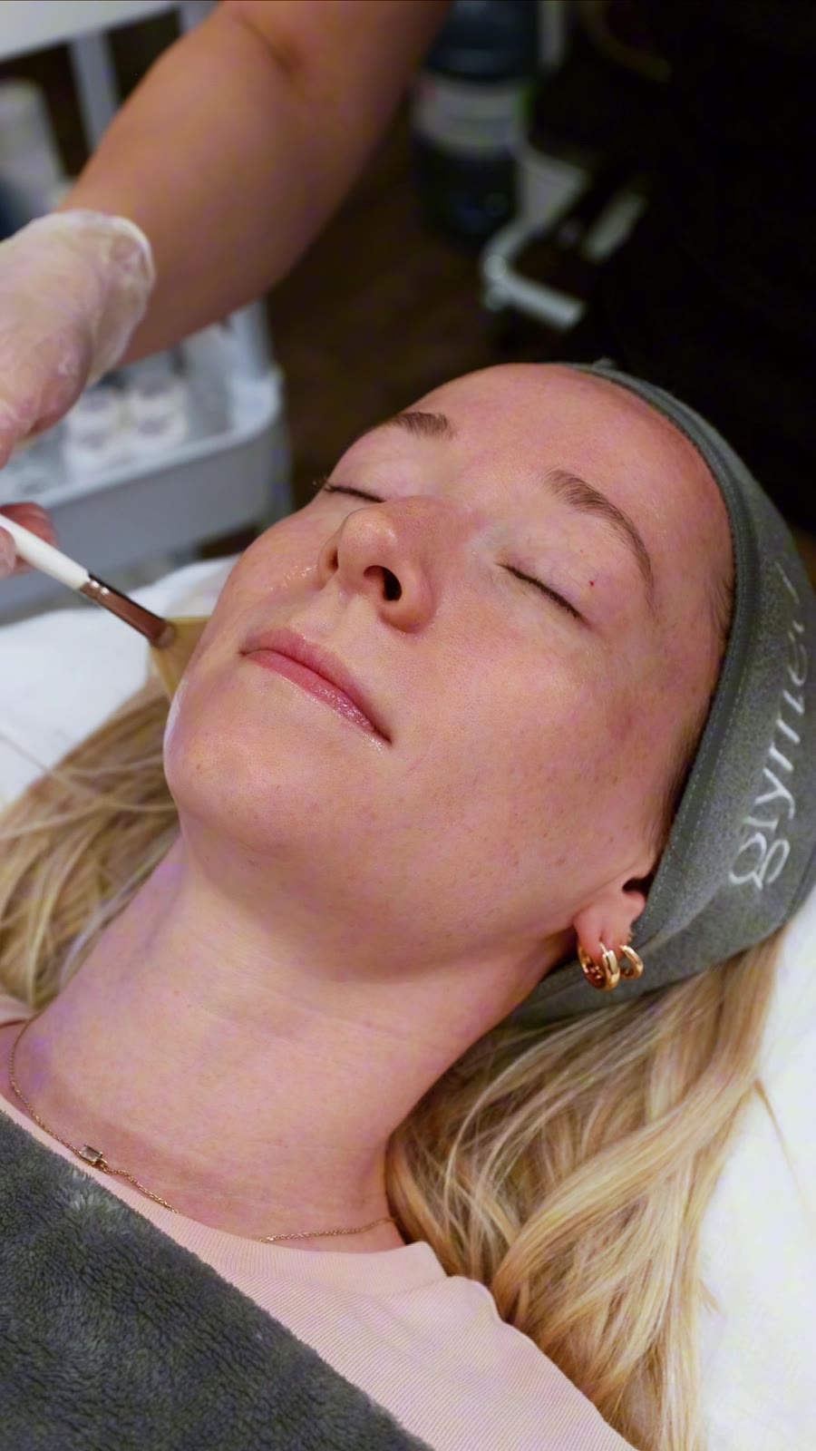 chemical-peel-application-calgary