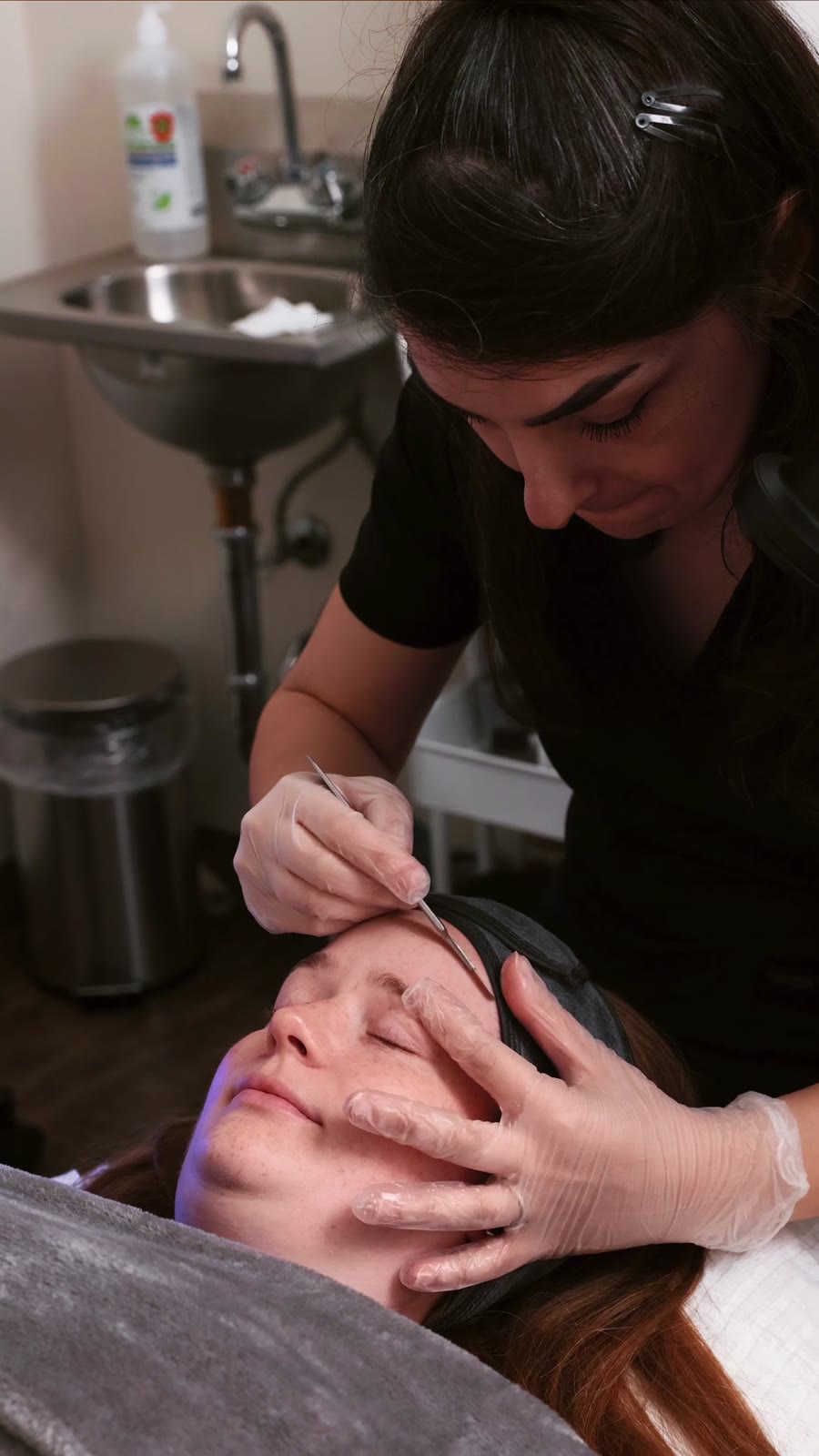 dermaplaning-treatment-calgary