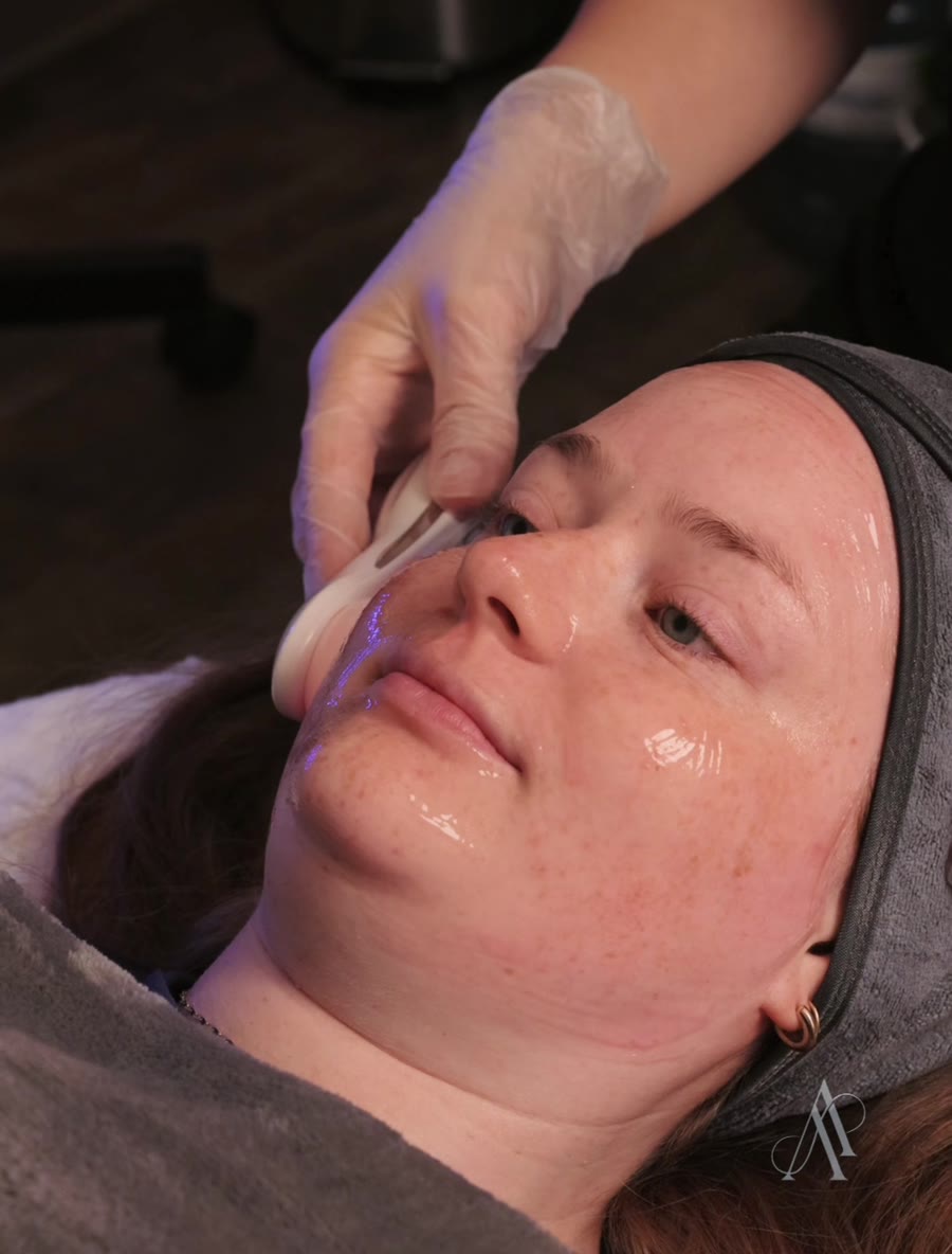 led-light-therapy-facial-calgary