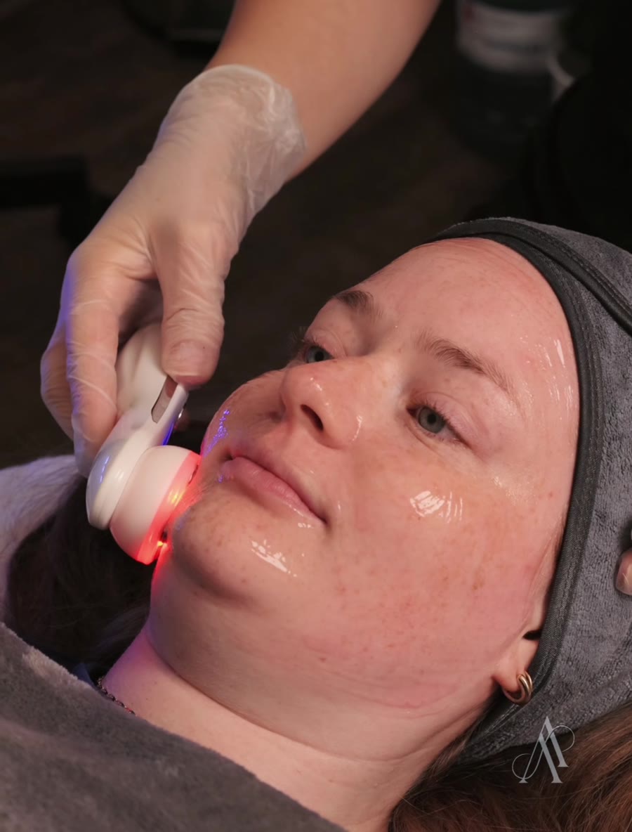 led-light-therapy-treatment-calgary